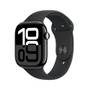Smartwatch EKG