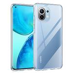 Chalpr Xiaomi-Mi-11-Hülle