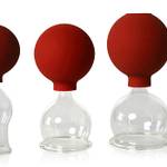 Schröpfglas
