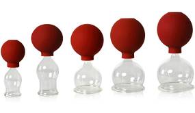 Schröpfglas