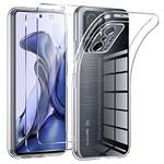 Xiaomi-11T-Pro-Hülle