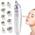 Mikrodermabrasion Maschine von TopDirect