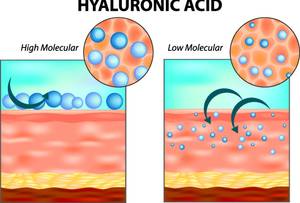 Schaubild: Hyaluron-Creme hochmolekular vs niedrigmolekular